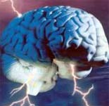 Le cerveau
